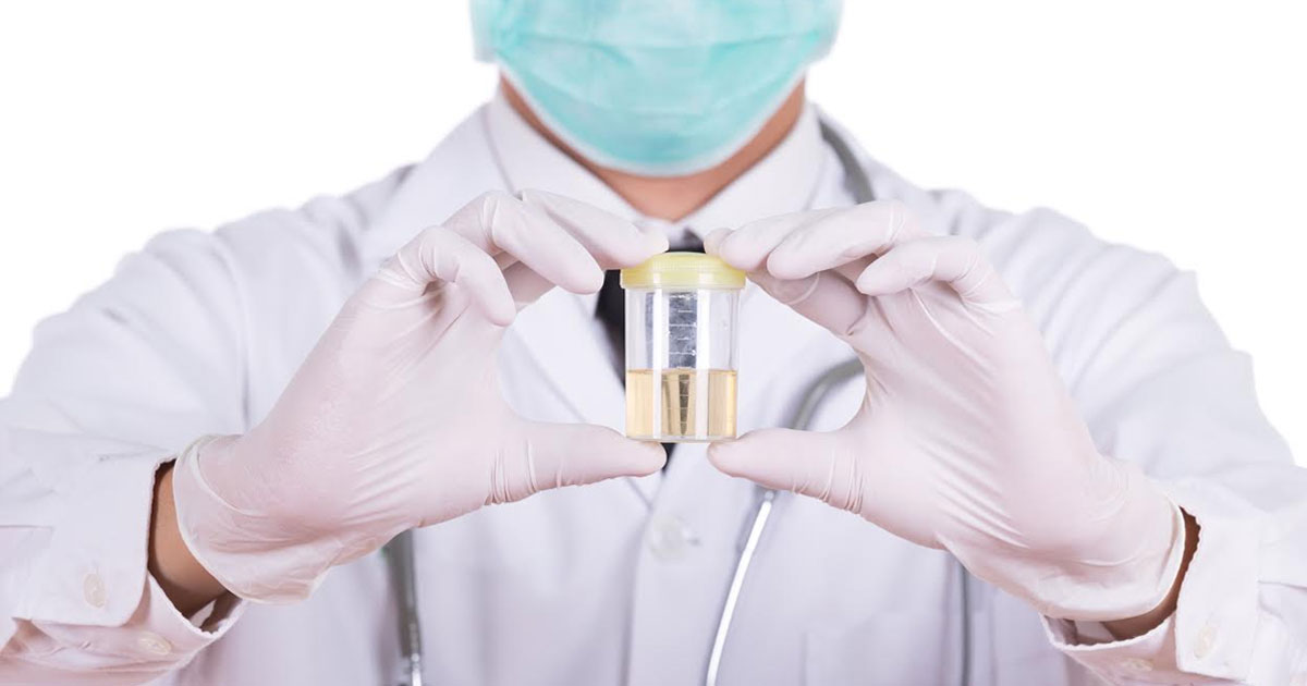 Is Drug Testing People on Welfare Effective