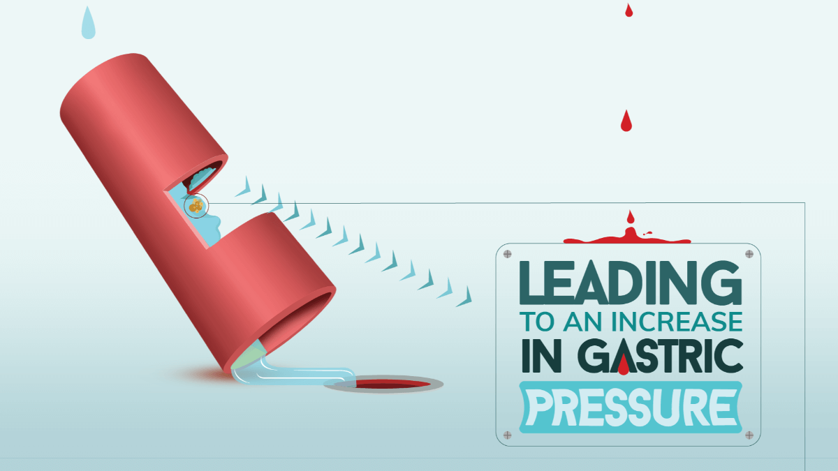 Alcohol and Gastric Pressure
