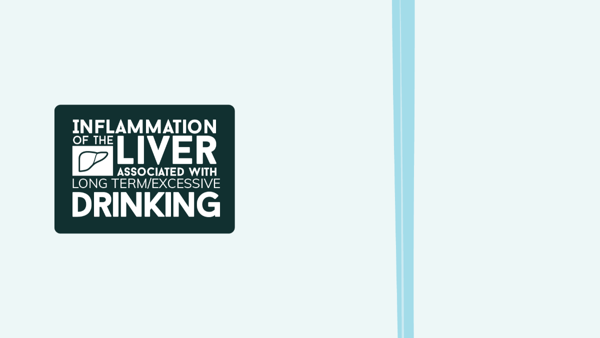 Alcohol and inflammation Of the Liver
